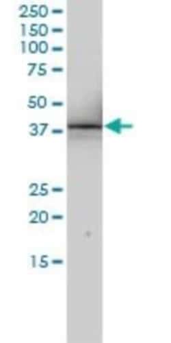 SNURPORTIN1 Antibody (2B2-1B4), Novus Biologicals 0.1 mg | Buy Online | Novus Biologicals | Fisher Scientific