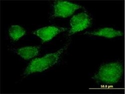SNX11 Antibody, Novus Biologicals 0.05 mg | Buy Online | Novus Biologicals | Fisher Scientific