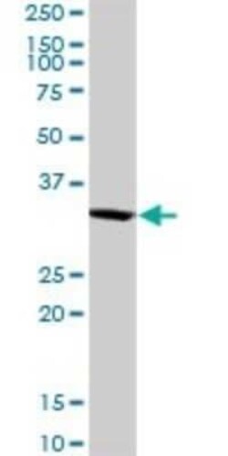 SNX11 Antibody, Novus Biologicals 0.1 mg | Buy Online | Novus Biologicals | Fisher Scientific