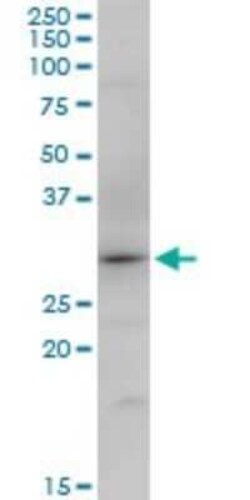 SNX12 Antibody, Novus Biologicals 0.05 mg | Buy Online | Novus Biologicals | Fisher Scientific