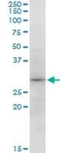 SNX12 Antibody, Novus Biologicals 0.05 mg | Buy Online | Novus Biologicals | Fisher Scientific