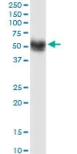 SNX17 Antibody (2A3), Novus Biologicals 0.1 mg | Buy Online | Novus Biologicals | Fisher Scientific