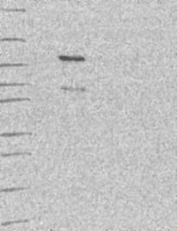 SNX29 Rabbit anti-Human, Polyclonal, Novus Biologicals:Antibodies:Primary