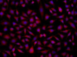 SOAT 2 Antibody, Novus Biologicals:Antibodies:Primary Antibodies