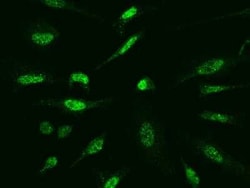 SOCS-1 Antibody, Novus Biologicals:Anticuerpos:Anticuerpos primarios