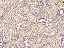 SOCS-1 Antibody, Novus Biologicals:Anticuerpos:Anticuerpos primarios