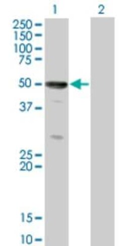 SOCS-4 Antibody (2G8), Novus Biologicals 0.1 mg; Unconjugated:Antibodies,