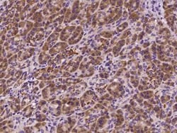 SOCS-4 Antibody, Novus Biologicals 50 &mu;g, Unconjugated:Antibodies, Polyclonal