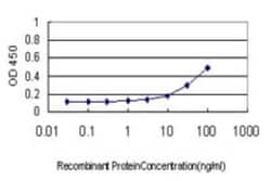 SOCS-6 Antibody (M2-F12), Novus Biologicals 0.1 mg | Buy Online | Novus Biologicals | Fisher Scientific