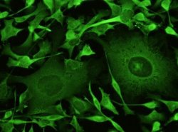 SOD1/Cu-Zn SOD Rabbit anti-Human, Clone: 101, Novus Biologicals 50 &mu;g;