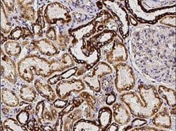 SOD2/Mn-SOD Rabbit anti-Human, Clone: 12, Novus Biologicals:Antibodies:Primary