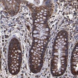SOD2/Mn-SOD Antibody, Novus Biologicals:Antibodies:Primary Antibodies