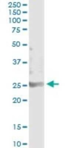 SOHLH2 Antibody (1E1), Novus Biologicals 0.1 mg | Buy Online | Novus Biologicals | Fisher Scientific