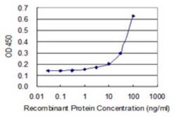 SOHLH2 Antibody (1E1), Novus Biologicals 0.1 mg | Buy Online | Novus Biologicals | Fisher Scientific