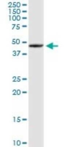 SOHLH2 Antibody, Novus Biologicals 0.1 mg | Buy Online | Novus Biologicals | Fisher Scientific