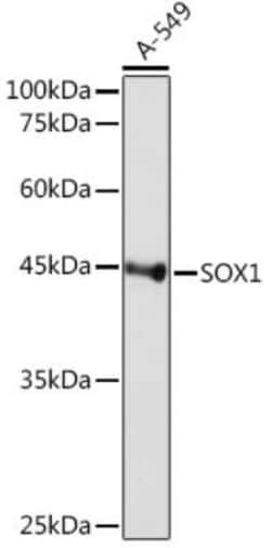 SOX1 Rabbit anti-Human, Mouse, Rat, Clone: 9L8Z4, Novus Biologicals 100