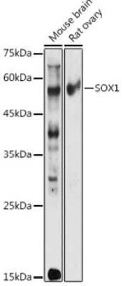 SOX1 Rabbit anti-Human, Mouse, Rat, Polyclonal, Novus Biologicals 20 &mu;g | Buy Online | Bio-Techne | Fisher Scientific