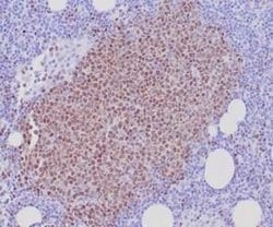 SOX11 Mouse anti-Human, Clone: SOX11/7236, Novus Biologicals 100 &mu;g;
