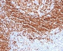 SOX11 Mouse anti-Human, Clone: SOX11/7236, Novus Biologicals 100 &mu;g;
