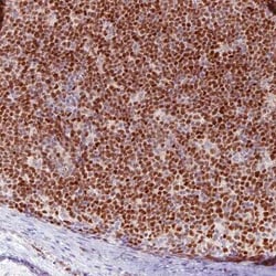 SOX11 Antibody (CL0143), Novus Biologicals:Antibodies:Primary Antibodies
