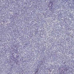 SOX11 Antibody (CL0143), Novus Biologicals 0.1 mL, Unconjugated:Antibodies,