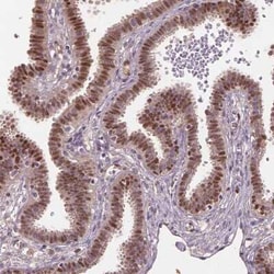 SOX17 Antibody, Novus Biologicals 25 &mu;L, Unconjugated:Antibodies, Polyclonal