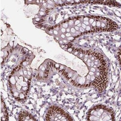 SOX17 Antibody, Novus Biologicals 25 &mu;L, Unconjugated:Antibodies, Polyclonal