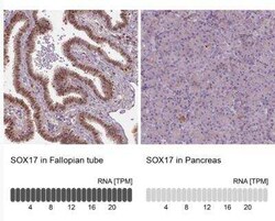 SOX17 Antibody, Novus Biologicals 25 &mu;L, Unconjugated:Antibodies, Polyclonal
