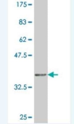 SOX21 Antibody (3H4), Novus Biologicals 0.1 mg | Buy Online | Novus Biologicals | Fisher Scientific