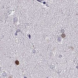 SOX21 Antibody, Novus Biologicals:Antibodies:Primary Antibodies