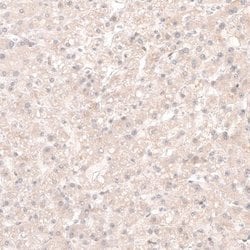 SOX4 Antibody (CL5634), Novus Biologicals 25 &mu;L:Antibodies, Monoclonal