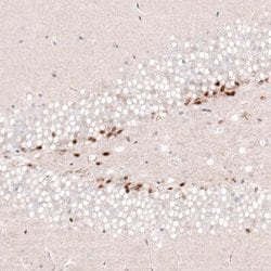 SOX4 Antibody (CL5634), Novus Biologicals 25 &mu;L:Antibodies, Monoclonal