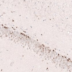 SOX4 Antibody (CL5634), Novus Biologicals 25 &mu;L:Antibodies, Monoclonal
