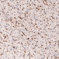 SOX4 Antibody (CL5665), Novus Biologicals 25 &mu;L:Antibodies, Monoclonal