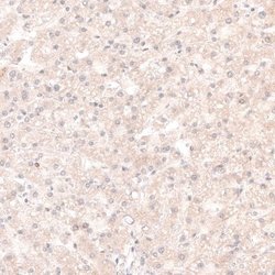 SOX4 Antibody (CL5665), Novus Biologicals 25 &mu;L:Antibodies, Monoclonal
