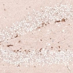 SOX4 Antibody (CL5665), Novus Biologicals 25 &mu;L:Antibodies, Monoclonal