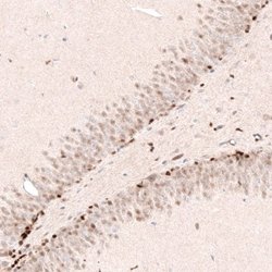 SOX4 Antibody (CL5665), Novus Biologicals 25 &mu;L:Antibodies, Monoclonal