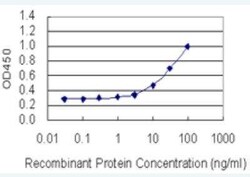 SOX5 Antibody (4H8), Novus Biologicals 100 &mu;g | Buy Online | Novus Biologicals | Fisher Scientific