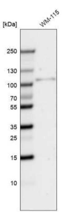 SOX6 Antibody (CL5685), Novus Biologicals:Antibodies:Primary Antibodies