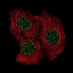 SOX6 Antibody (CL5690), Novus Biologicals:Antibodies:Primary Antibodies