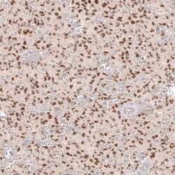SOX6 Antibody (CL5690), Novus Biologicals:Antibodies:Primary Antibodies