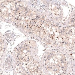 SOX6 Antibody (CL5690), Novus Biologicals:Antibodies:Primary Antibodies