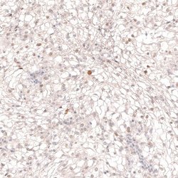 SOX6 Antibody (CL5690), Novus Biologicals:Antibodies:Primary Antibodies