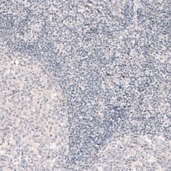 SOX6 Antibody (CL5690), Novus Biologicals:Antibodies:Primary Antibodies