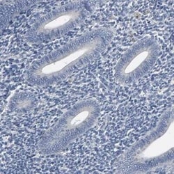 SOX6 Antibody, Novus Biologicals 25 &mu;L | Buy Online | Novus Biologicals | Fisher Scientific
