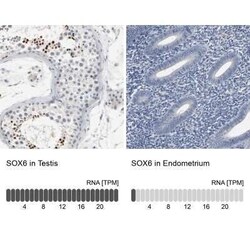 SOX6 Antibody, Novus Biologicals 25 &mu;L | Buy Online | Novus Biologicals | Fisher Scientific