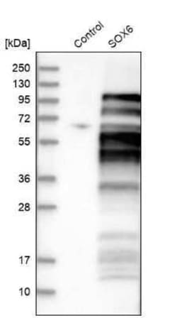 SOX6 Antibody, Novus Biologicals 25 &mu;L | Buy Online | Novus Biologicals | Fisher Scientific