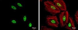 SOX8 Antibody, Novus Biologicals 100 &mu;g; Unconjugated:Antibodies, Polyclonal