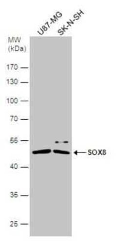 SOX8 Antibody, Novus Biologicals 100 &mu;g; Unconjugated:Antibodies, Polyclonal