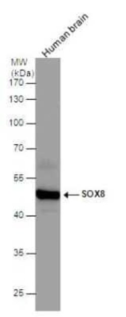 SOX8 Antibody, Novus Biologicals 100 &mu;g; Unconjugated:Antibodies, Polyclonal